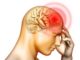 meningite2