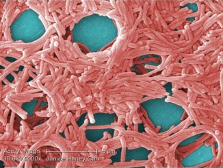 Legionella
