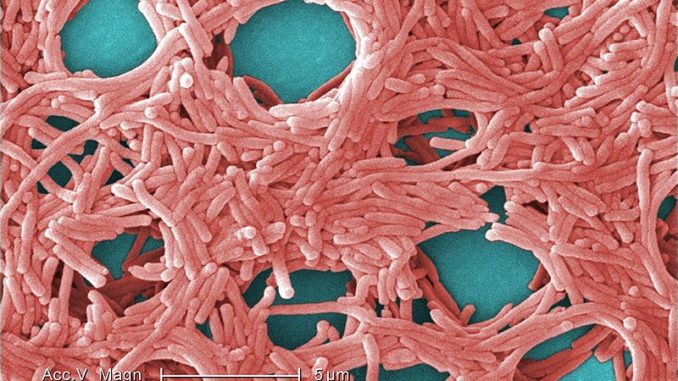 Legionella Legionella