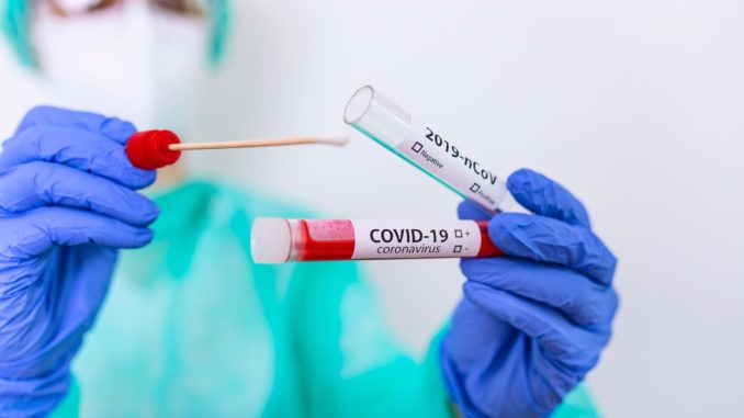 TAMPONE-CORONAVIRUS-COVID-scaled